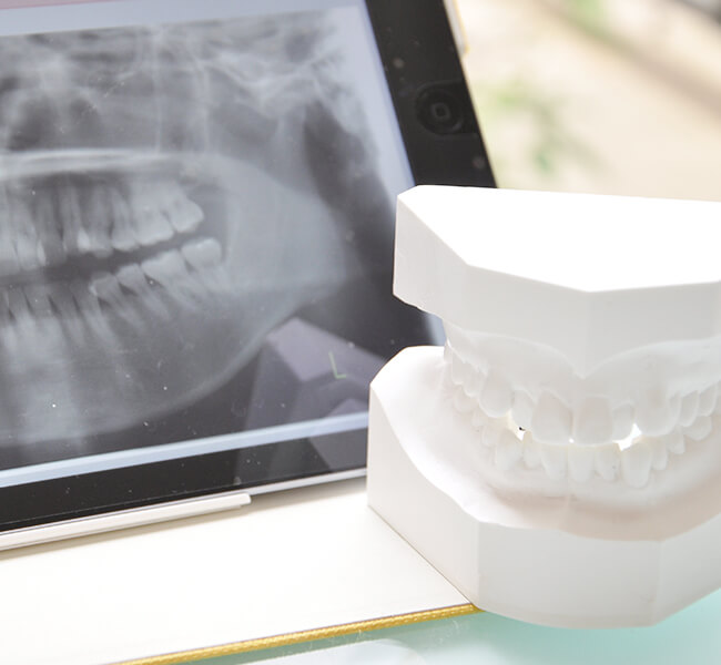 歯の模型・レントゲンのイメージ
