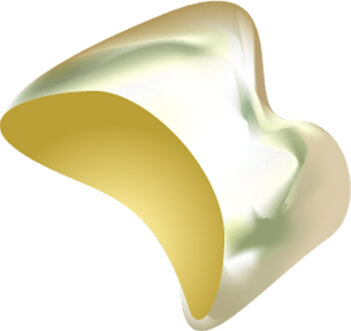 ゴールドクラウン