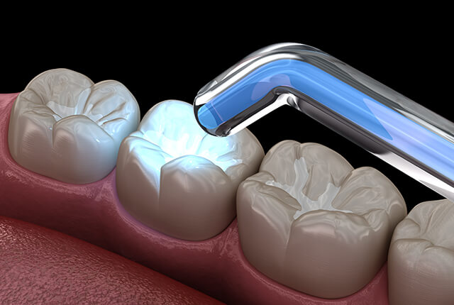 シーラントのイメージ